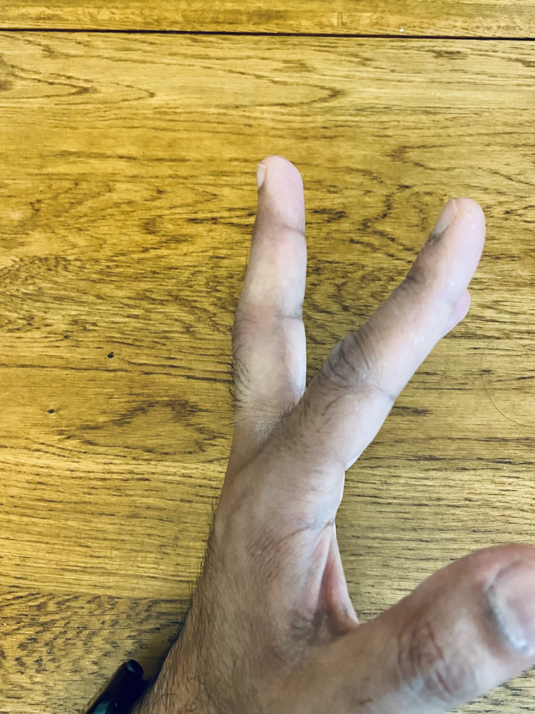 Bend in middle finger